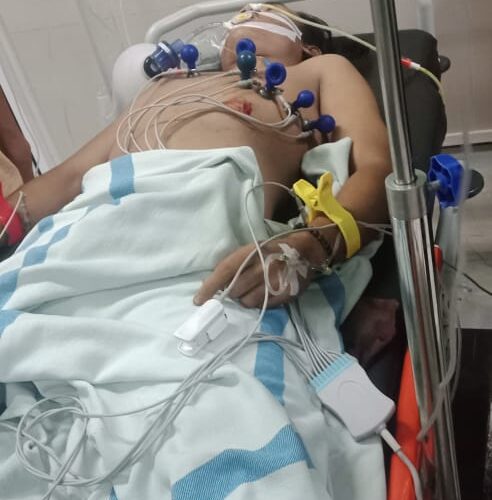Pasal Lama Berujung Maut